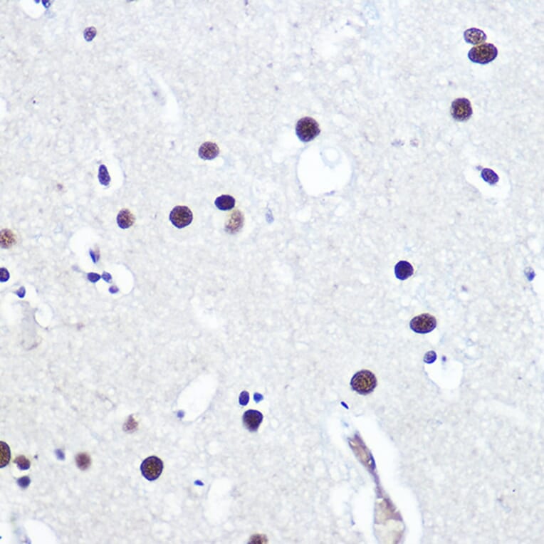 Immunohistochemistry - Anti-53BP1 Antibody (A305436) - Antibodies.com