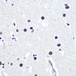 Immunohistochemistry - Anti-53BP1 Antibody (A305436) - Antibodies.com