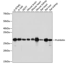 Western Blot - Anti-Prohibitin Antibody [ARC0007] (A305437) - Antibodies.com