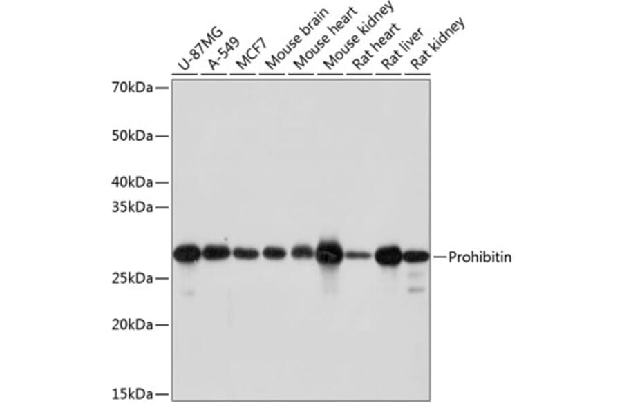 Western Blot - Anti-Prohibitin Antibody [ARC0007] (A305437) - Antibodies.com