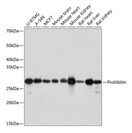 Western Blot - Anti-Prohibitin Antibody [ARC0007] (A305437) - Antibodies.com