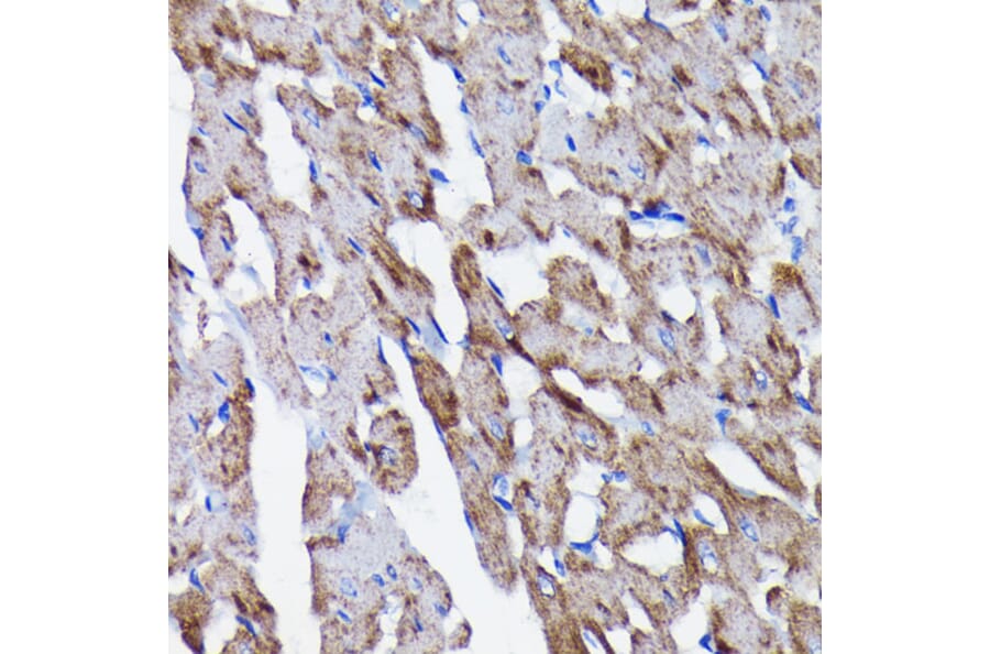 Immunohistochemistry - Anti-Prohibitin Antibody [ARC0007] (A305437) - Antibodies.com