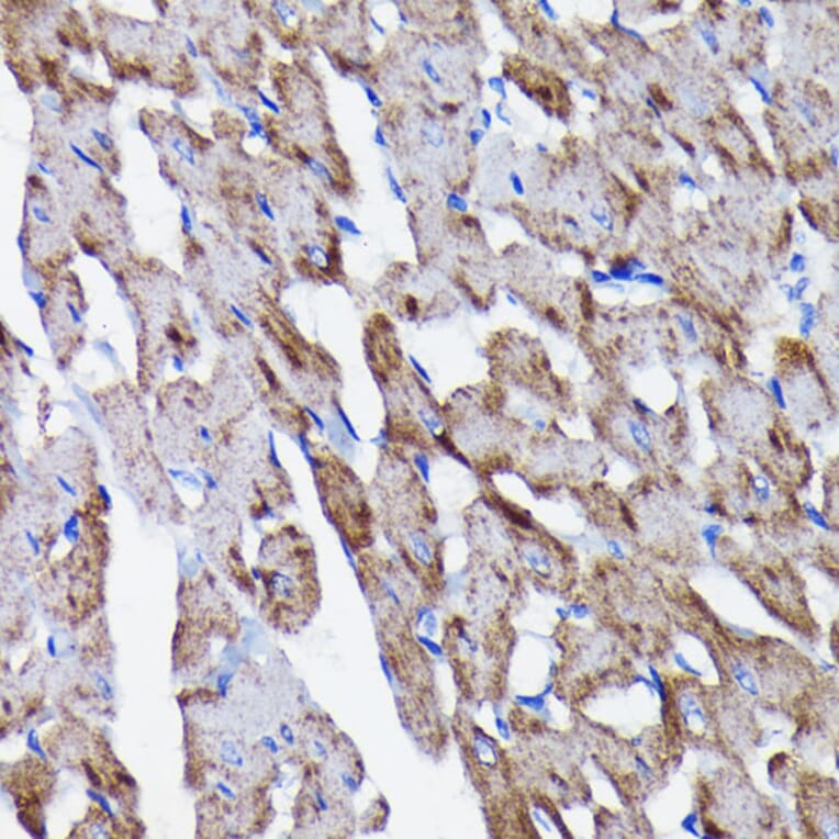 Immunohistochemistry - Anti-Prohibitin Antibody [ARC0007] (A305437) - Antibodies.com