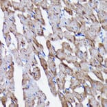Immunohistochemistry - Anti-Prohibitin Antibody [ARC0007] (A305437) - Antibodies.com