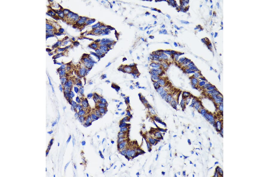 Immunohistochemistry - Anti-Prohibitin Antibody [ARC0007] (A305437) - Antibodies.com