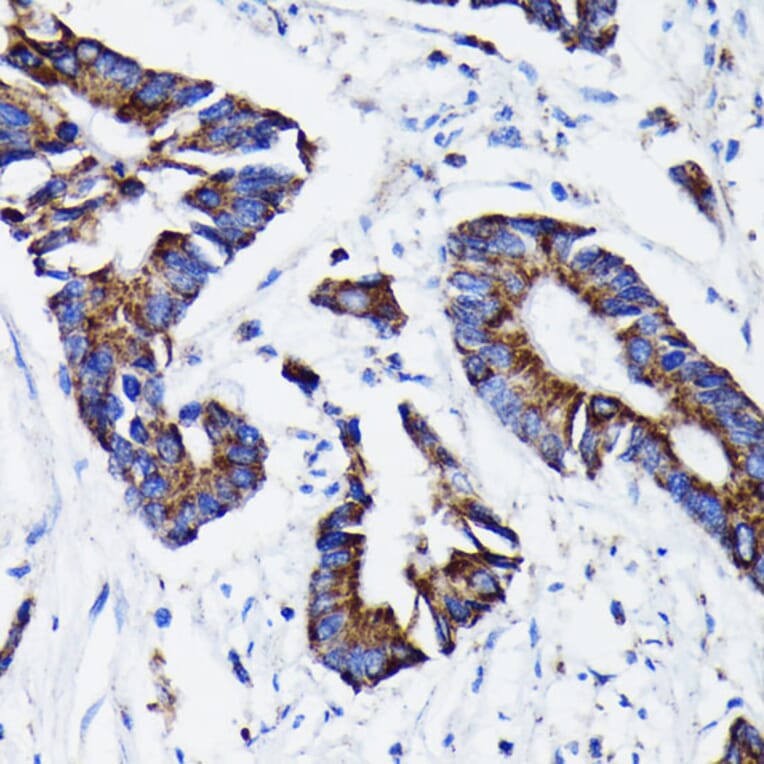 Immunohistochemistry - Anti-Prohibitin Antibody [ARC0007] (A305437) - Antibodies.com