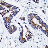 Immunohistochemistry - Anti-Prohibitin Antibody [ARC0007] (A305437) - Antibodies.com