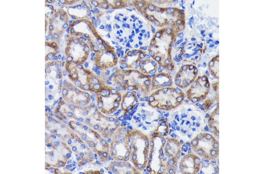 Immunohistochemistry - Anti-Prohibitin Antibody [ARC0007] (A305437) - Antibodies.com