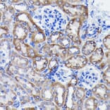 Immunohistochemistry - Anti-Prohibitin Antibody [ARC0007] (A305437) - Antibodies.com
