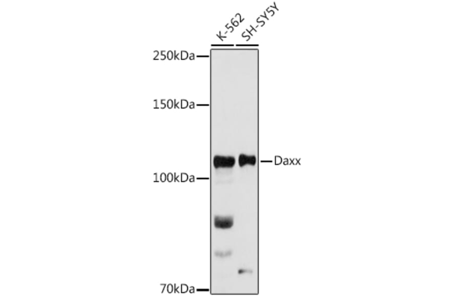 Western Blot - Anti-Daxx Antibody (A305438) - Antibodies.com