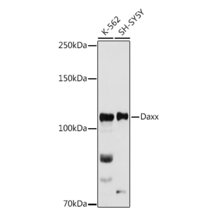 Western Blot - Anti-Daxx Antibody (A305438) - Antibodies.com