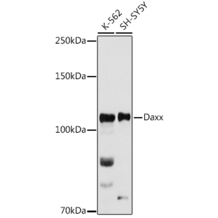 Western Blot - Anti-Daxx Antibody (A305438) - Antibodies.com