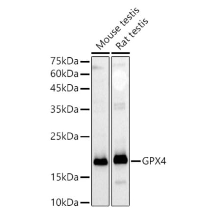 Western Blot - Anti-Glutathione Peroxidase 4 Antibody (A305439) - Antibodies.com