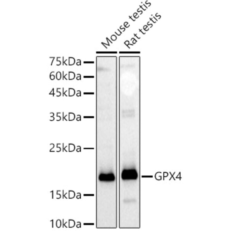 Western Blot - Anti-Glutathione Peroxidase 4 Antibody (A305439) - Antibodies.com