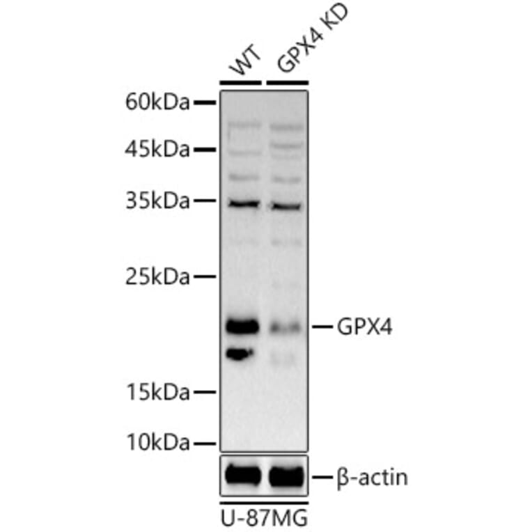 Western Blot - Anti-Glutathione Peroxidase 4 Antibody (A305439) - Antibodies.com