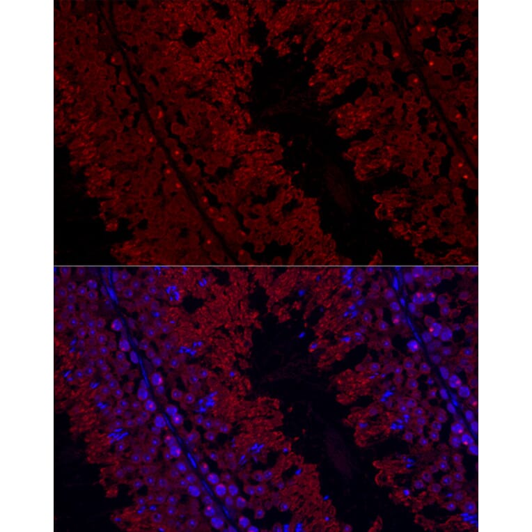 Immunofluorescence - Anti-Glutathione Peroxidase 4 Antibody (A305439) - Antibodies.com