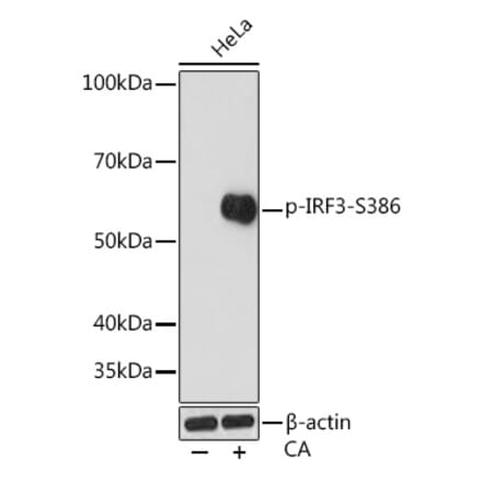 Western Blot - Anti-IRF3 (phospho Ser386) Antibody [ARC1539] (A305440) - Antibodies.com