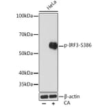 Western Blot - Anti-IRF3 (phospho Ser386) Antibody [ARC1539] (A305440) - Antibodies.com