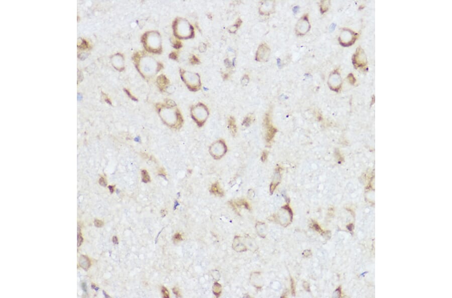 Immunohistochemistry - Anti-NEURL1B Antibody (A305441) - Antibodies.com