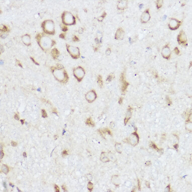 Immunohistochemistry - Anti-NEURL1B Antibody (A305441) - Antibodies.com
