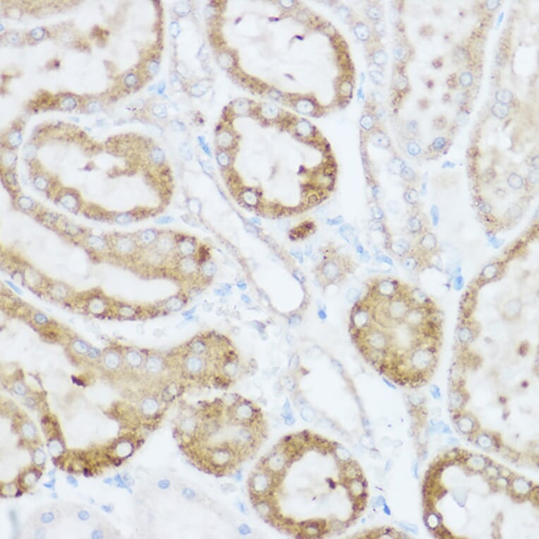 Immunohistochemistry - Anti-NEURL1B Antibody (A305441) - Antibodies.com