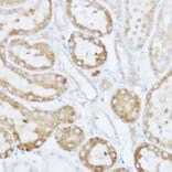 Immunohistochemistry - Anti-NEURL1B Antibody (A305441) - Antibodies.com
