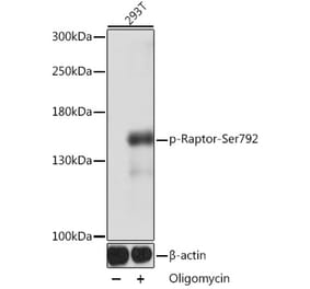 Western Blot - Anti-Raptor (phospho Ser729) Antibody (A305442) - Antibodies.com