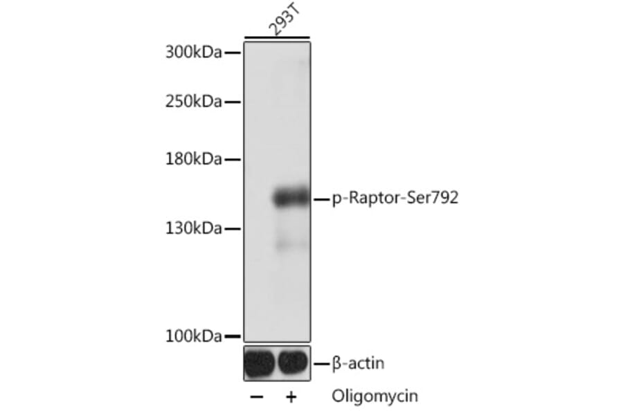 Western Blot - Anti-Raptor (phospho Ser729) Antibody (A305442) - Antibodies.com