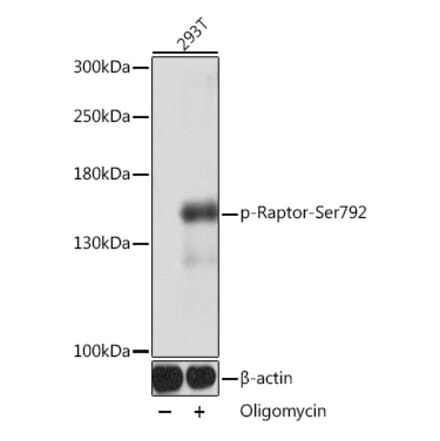 Western Blot - Anti-Raptor (phospho Ser729) Antibody (A305442) - Antibodies.com