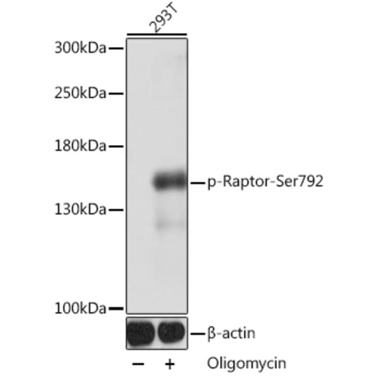 Western Blot - Anti-Raptor (phospho Ser729) Antibody (A305442) - Antibodies.com
