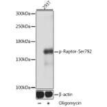 Western Blot - Anti-Raptor (phospho Ser729) Antibody (A305442) - Antibodies.com