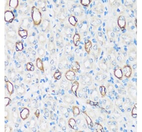 Immunohistochemistry - Anti-Aquaporin 2 Antibody (A305443) - Antibodies.com