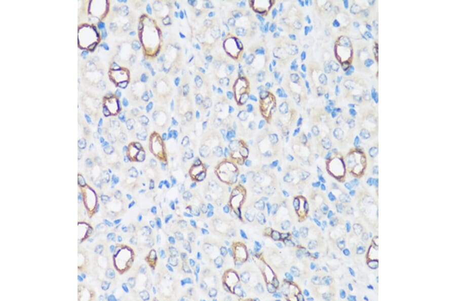 Immunohistochemistry - Anti-Aquaporin 2 Antibody (A305443) - Antibodies.com