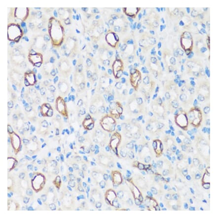 Immunohistochemistry - Anti-Aquaporin 2 Antibody (A305443) - Antibodies.com
