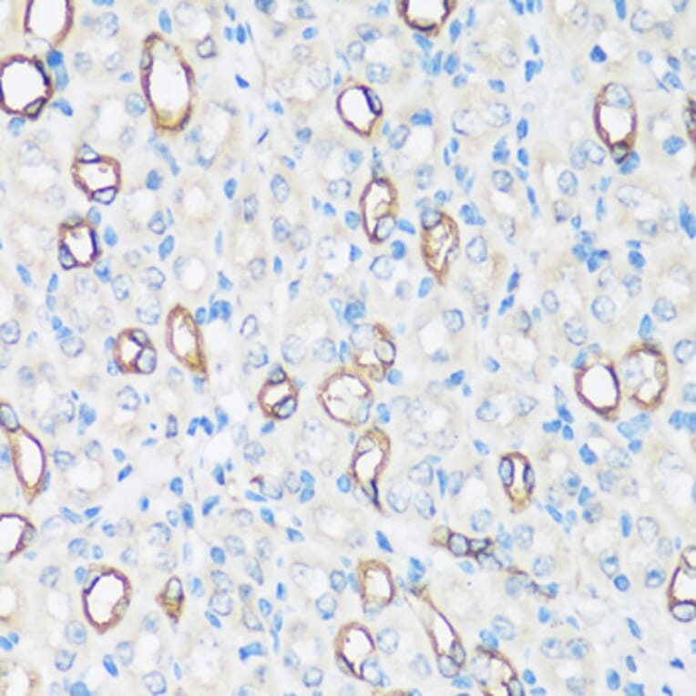 Immunohistochemistry - Anti-Aquaporin 2 Antibody (A305443) - Antibodies.com