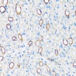 Immunohistochemistry - Anti-Aquaporin 2 Antibody (A305443) - Antibodies.com