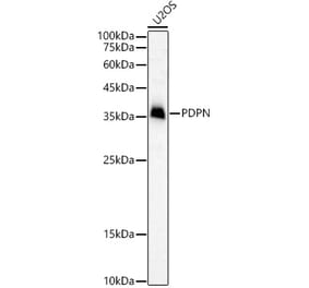 Western Blot - Anti-Podoplanin / gp36 Antibody (A305444) - Antibodies.com