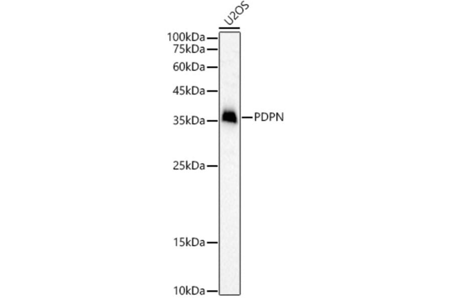 Western Blot - Anti-Podoplanin/gp36 Antibody (A305444) - Antibodies.com