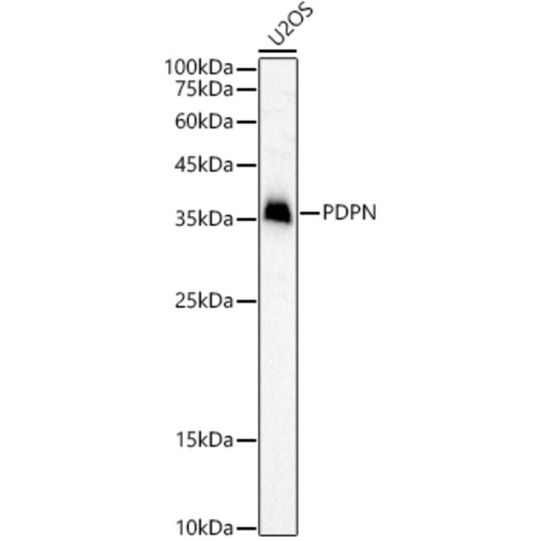 Western Blot - Anti-Podoplanin/gp36 Antibody (A305444) - Antibodies.com