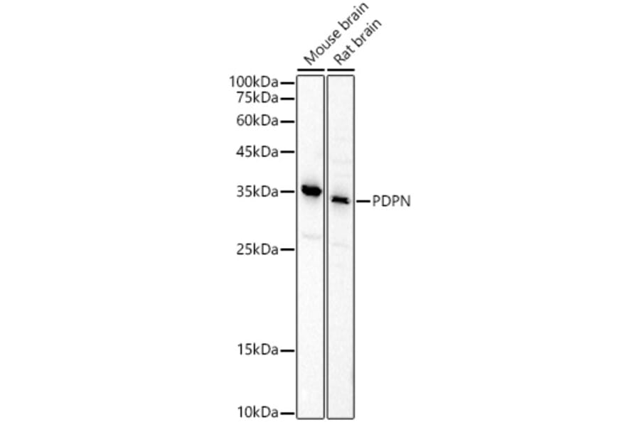 Western Blot - Anti-Podoplanin/gp36 Antibody (A305444) - Antibodies.com