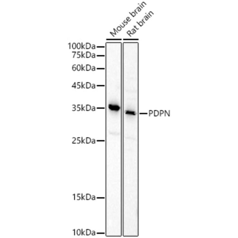 Western Blot - Anti-Podoplanin/gp36 Antibody (A305444) - Antibodies.com