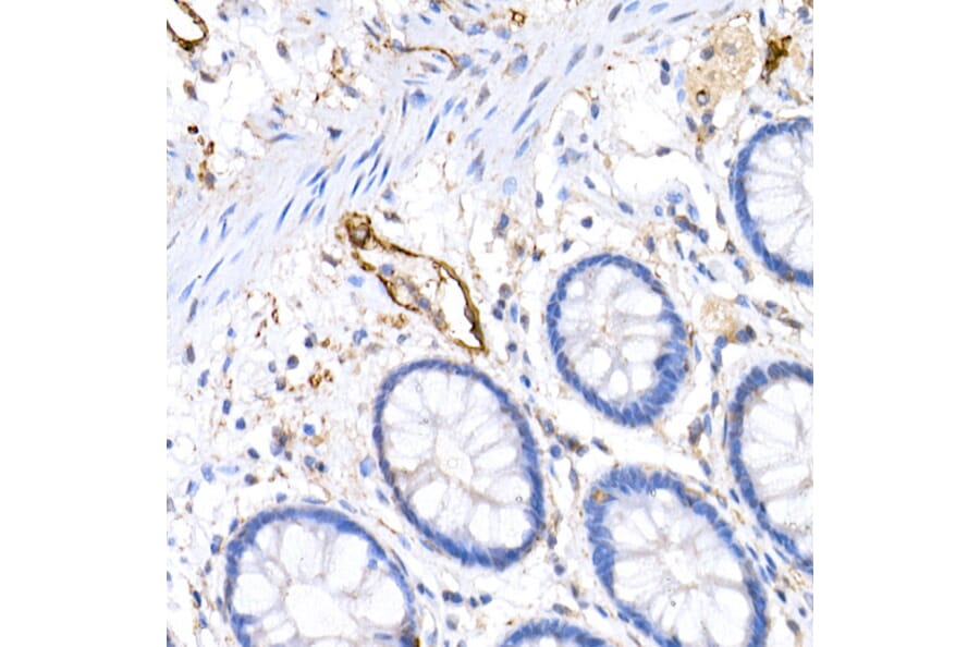 Immunohistochemistry - Anti-Podoplanin/gp36 Antibody (A305444) - Antibodies.com
