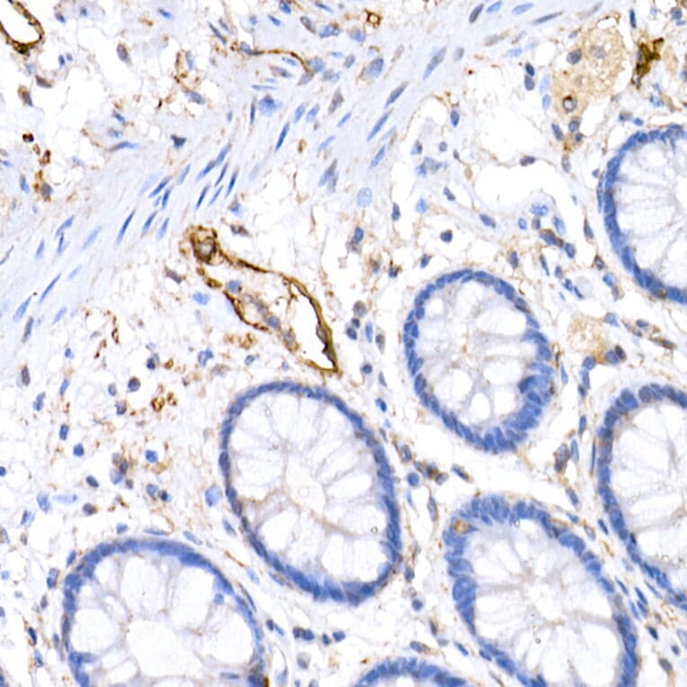 Immunohistochemistry - Anti-Podoplanin/gp36 Antibody (A305444) - Antibodies.com