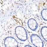 Immunohistochemistry - Anti-Podoplanin/gp36 Antibody (A305444) - Antibodies.com