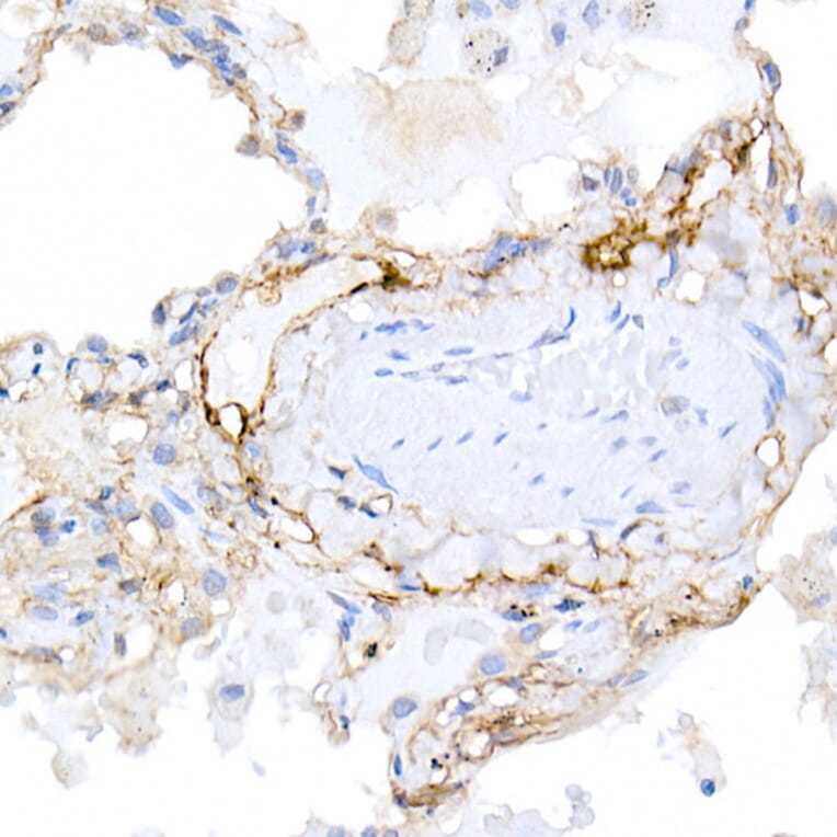 Immunohistochemistry - Anti-Podoplanin/gp36 Antibody (A305444) - Antibodies.com