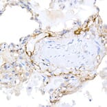Immunohistochemistry - Anti-Podoplanin/gp36 Antibody (A305444) - Antibodies.com