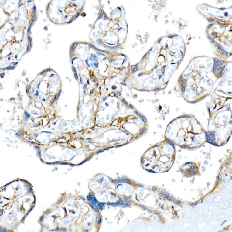 Immunohistochemistry - Anti-Podoplanin/gp36 Antibody (A305444) - Antibodies.com