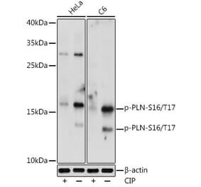 Western Blot - Anti-Phospholamban (phospho Ser16 + Thr17) Antibody (A305445) - Antibodies.com