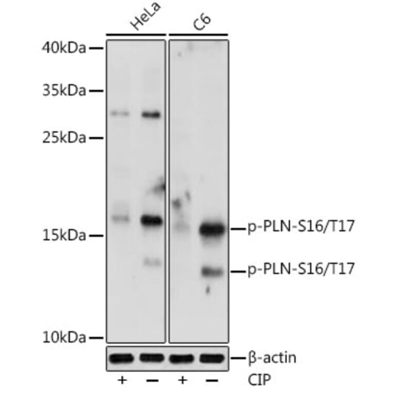 Western Blot - Anti-Phospholamban (phospho Ser16 + Thr17) Antibody (A305445) - Antibodies.com