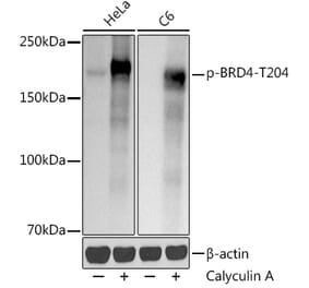 Western Blot - Anti-Brd4 (phospho Thr204) Antibody [ARC50960] (A305446) - Antibodies.com